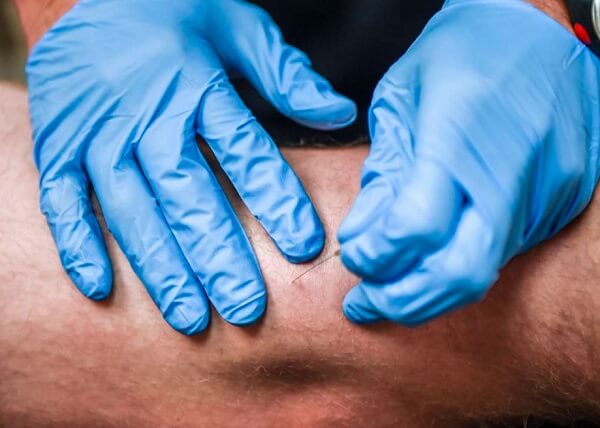 persons hand holding needle